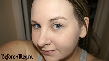 before before
